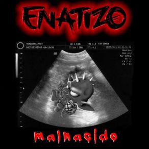 Download track Vacío Enatizo