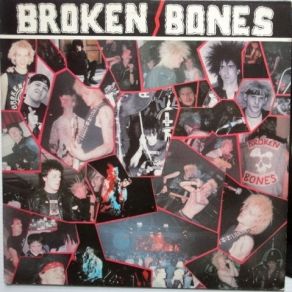 Download track Never Say Die Broken Bones